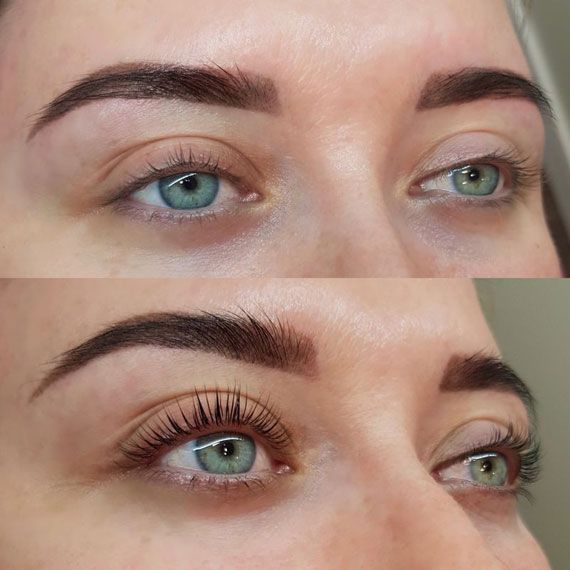 Antakiai ir blakstienos